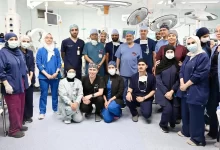 نجاح فصل التوأم الطفيلي المصري بالرياض