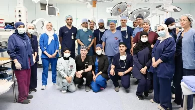 نجاح فصل التوأم الطفيلي المصري بالرياض