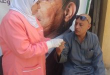 حملة «100 يوم صحة» تقدم 77 مليونًا و68 ألف خدمة طبية مجانية خلال 53 يومًا