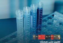 بنك saib يقدّم 30% خصما لعملائه في معامل  التحاليل والأشعة