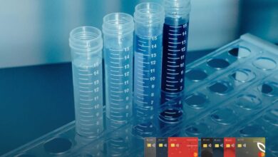 بنك saib يقدّم 30% خصما لعملائه في معامل  التحاليل والأشعة