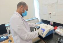 الرعاية الصحية: مستشفى رمد أسوان يقدم 250 ألف خدمة طبية